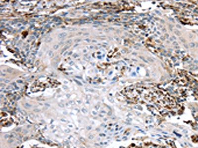 TBXA2R Antibody