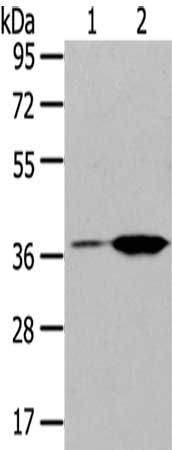 TBXA2R Antibody