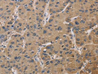 TBXAS1 Antibody