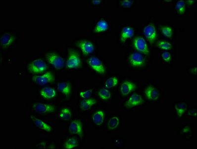 TCAF2 Antibody
