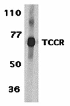 TCCR Antibody