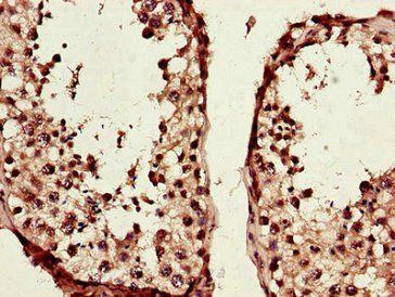 TCF3 Antibody