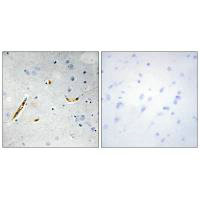 TCF3 Antibody