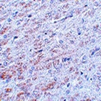 TCF3 Rabbit Polyclonal Antibody