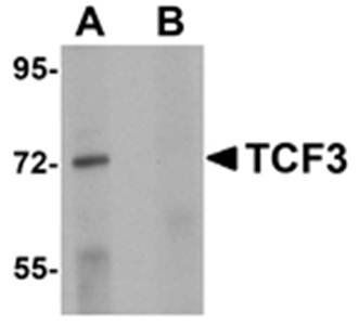 TCF3 Rabbit Polyclonal Antibody