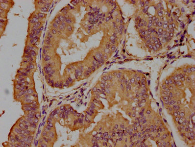 TCHH Antibody