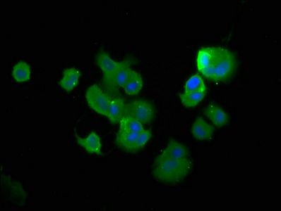 TCHP Antibody