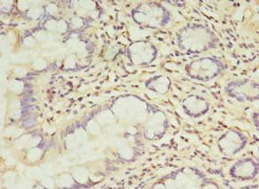 TCHP Antibody