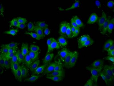 TCIRG1 Antibody