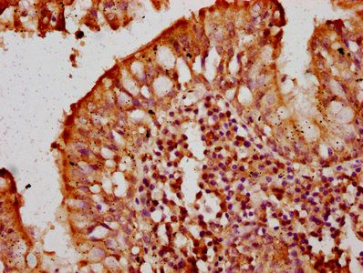 TCIRG1 Antibody