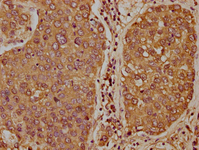 TCL1B antibody