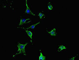 TCN2 Antibody