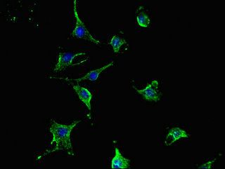 TCN2 antibody