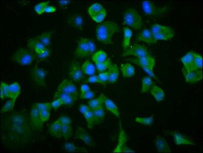 TCP1 Antibody