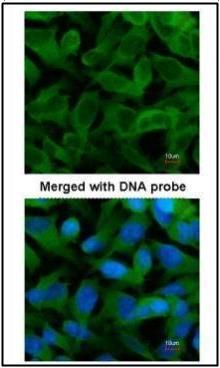 chaperonin containing TCP1 subunit 5 Antibody