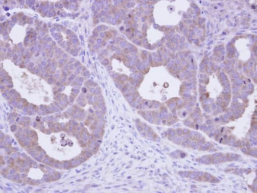 chaperonin containing TCP1 subunit 5 Antibody