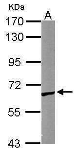 chaperonin containing TCP1 subunit 5 Antibody