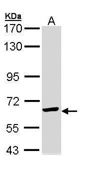 TCP1 epsilon antibody