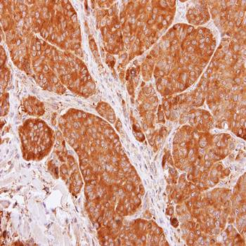 TCP beta antibody
