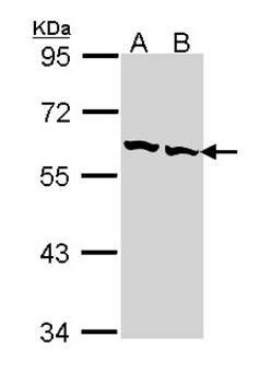 TCP beta antibody