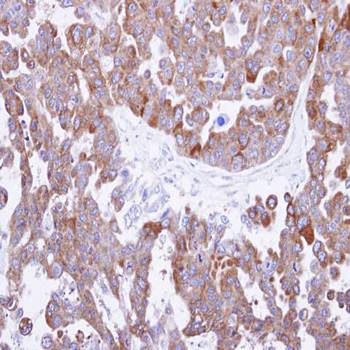 TCP theta antibody