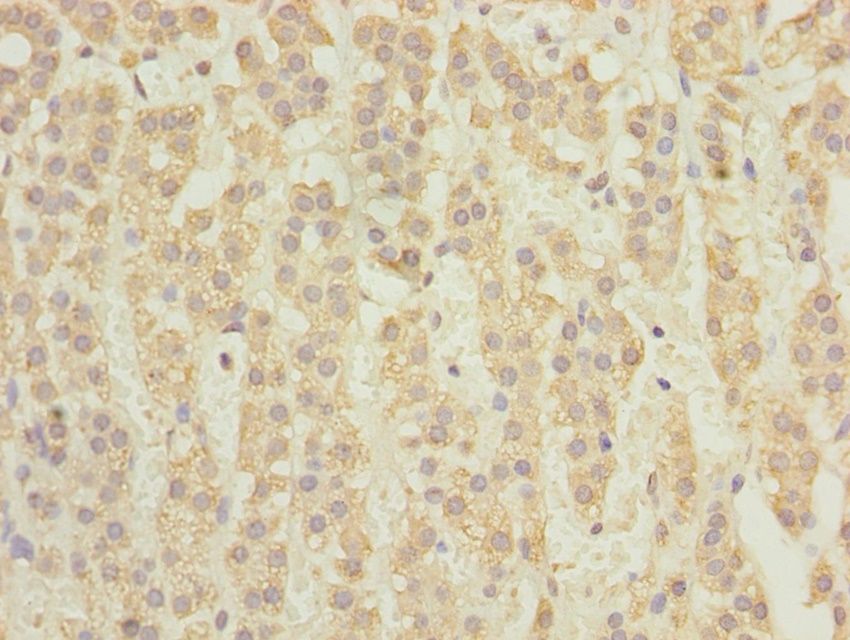 TCTA antibody