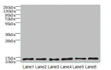 TCTA antibody