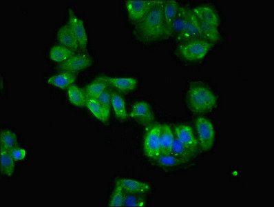 TCTE1 antibody