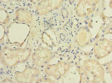 TCTE1 Antibody