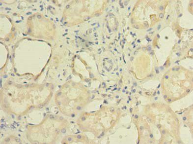 TCTE1 antibody