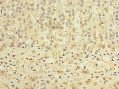 TCTE1 Antibody