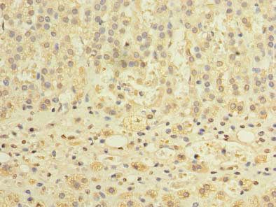 TCTE1 antibody