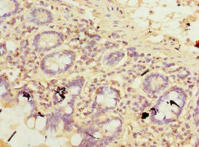 TCTEX1D2 Antibody
