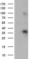 TCTN2 Antibody