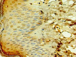 TCTN2 Antibody
