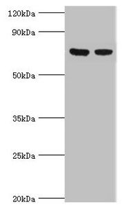 TCTN2 antibody