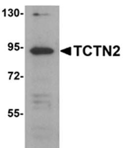 TCTN2 Rabbit Polyclonal Antibody