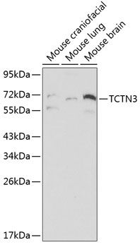 TCTN3 antibody