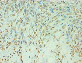 TDP1 Antibody