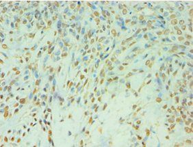 TDP1 antibody