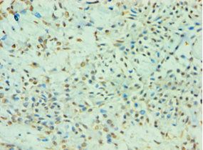 TDP1 Antibody