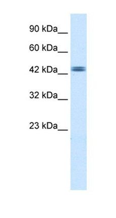 TDP2 antibody