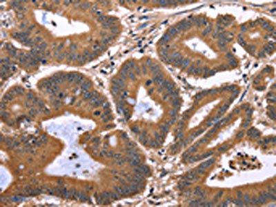 TDP2 antibody