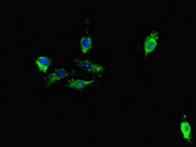 TDRD1 antibody