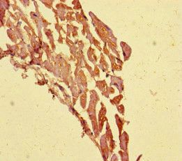 TECPR1 Antibody
