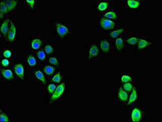 TECPR2 Antibody