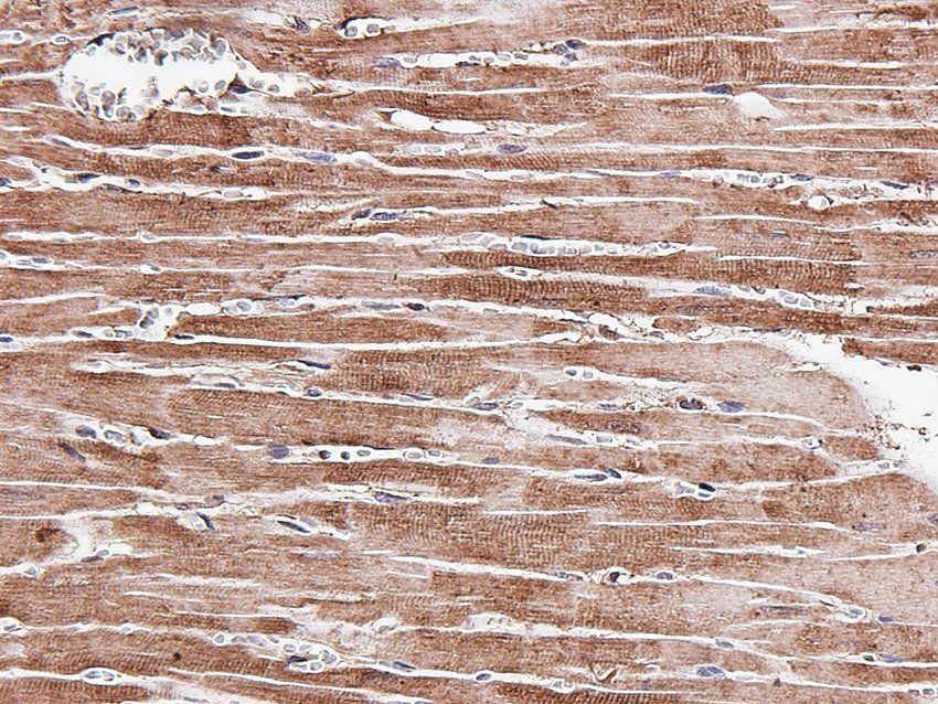 TEK Rabbit Polyclonal Antibody