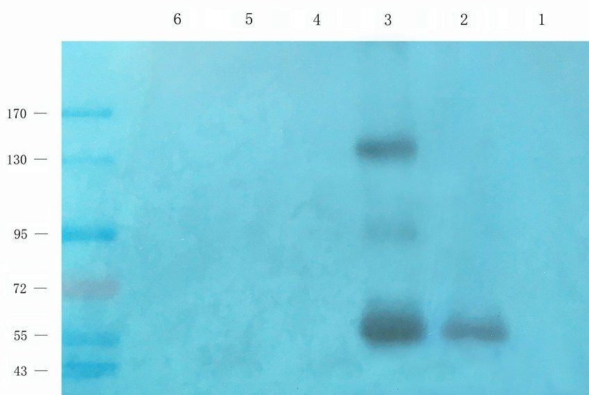 TEK antibody