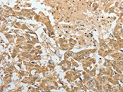 TEKT1 Antibody