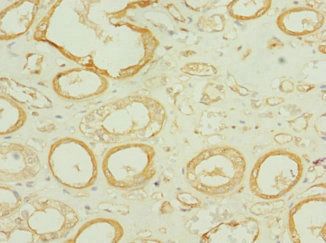 TEKT3 Antibody
